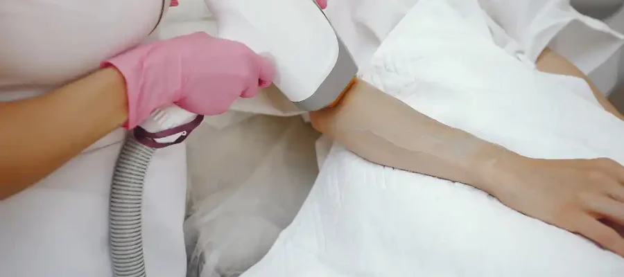 En Etkili Lazer Epilasyon Hangisidir?